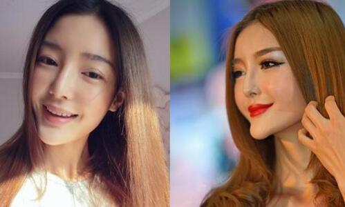 整形败明星,美丽背后的代价与反思